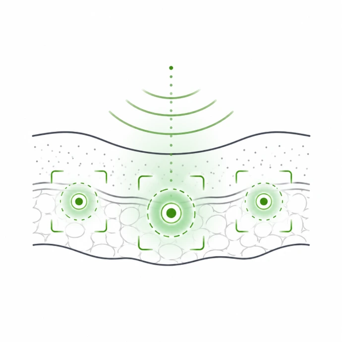Identificación de las áreas de interés Electroterapia Adaptativa